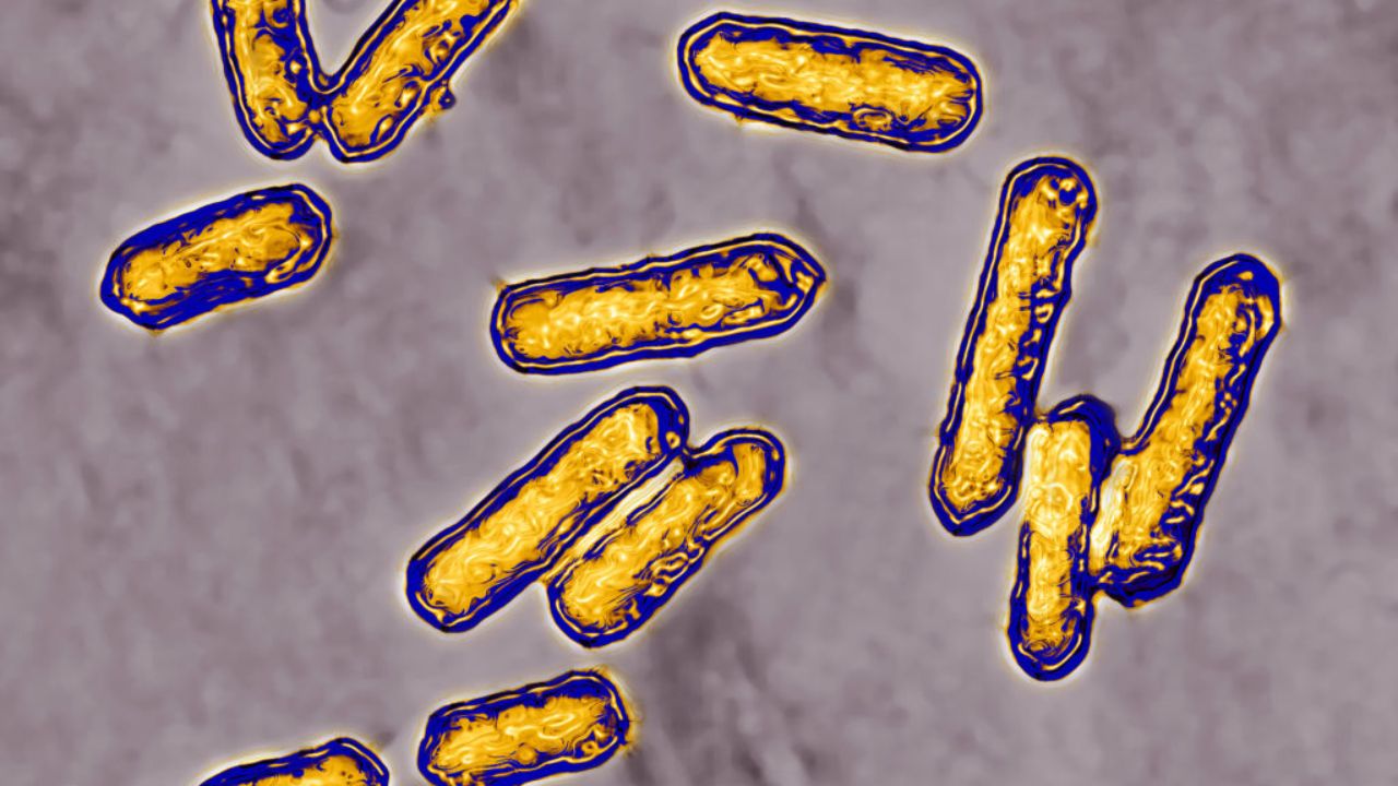 CDC Reports 3 Deaths in Listeria Outbreak from Boar’s Head Deli Products